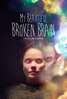 My Beautiful Broken Brain Torrent - WEB-DL 720p/1080p Dual Áudio My Beautiful Broken Brain Torrent - WEB-DL 720p/1080p Dual Áudio